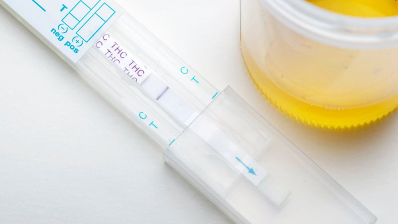 Urine for Drug Test