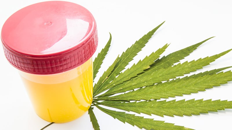 Marijuana leaf and urine sample for drug test