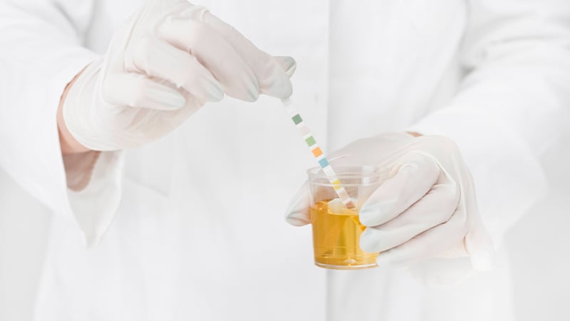 Close up of doctor holding urine sample for HHC drug teset.